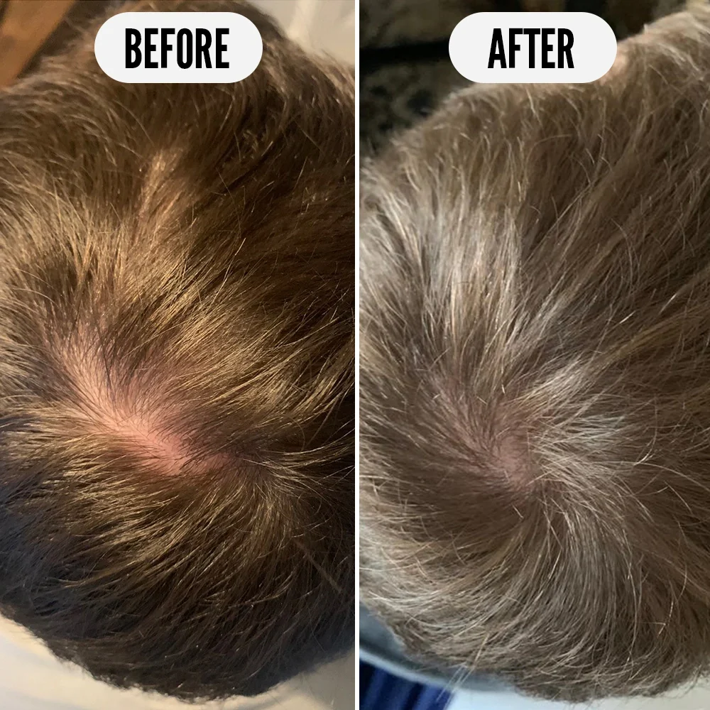 Get Set, Grow Growth Tonic - 75ml - Image 4